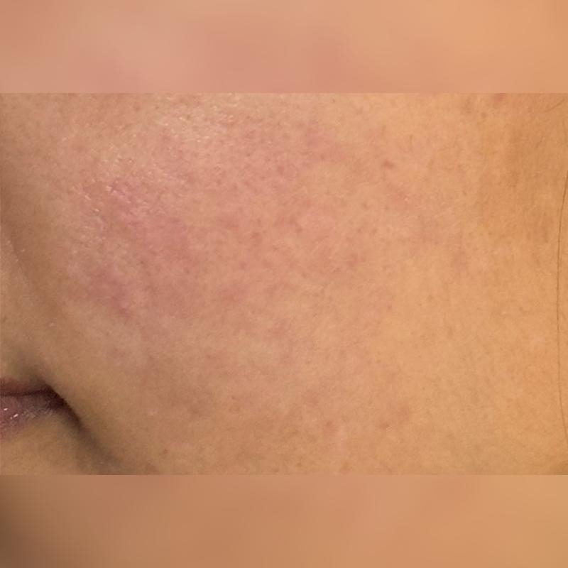 before_image