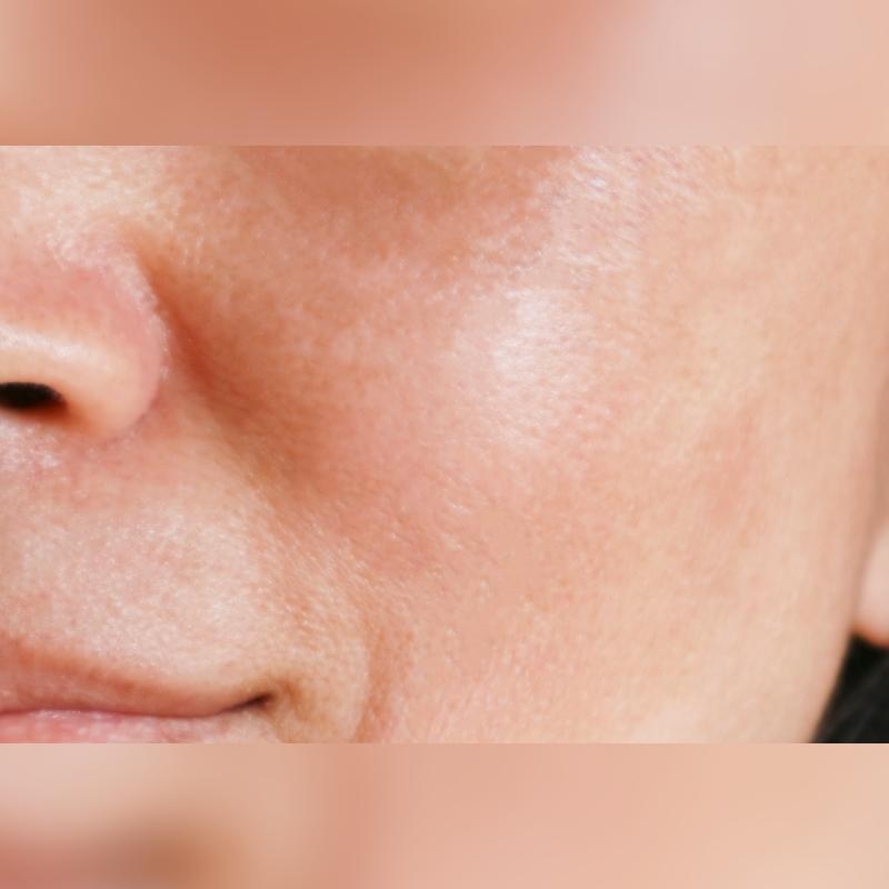 before_image