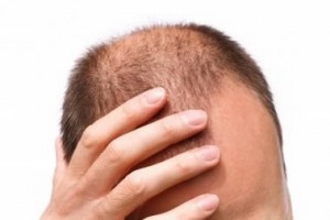 Stem Cell Therapy For Hair Care