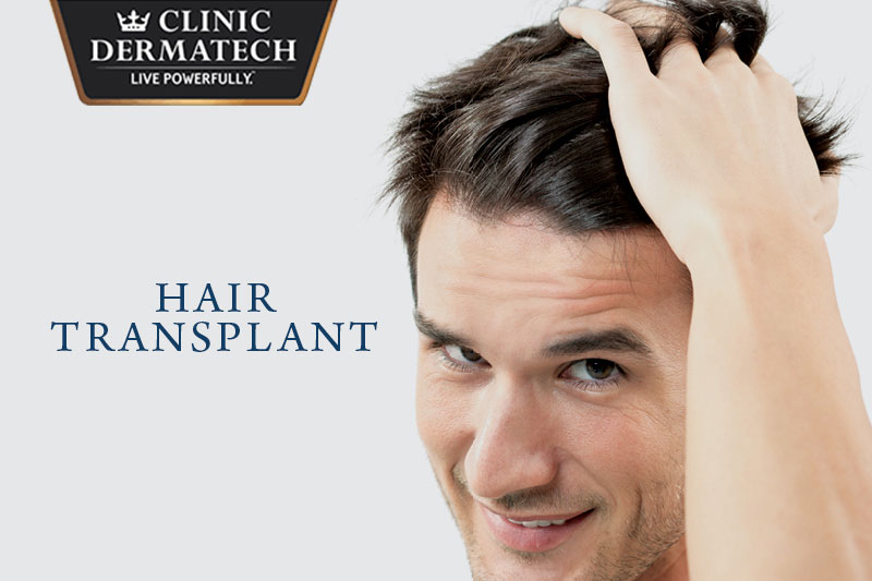 Why have a Hair Transplant in India rather than anywhere else in the world?  - Skin & hair care Tips - Clinic Dermatech