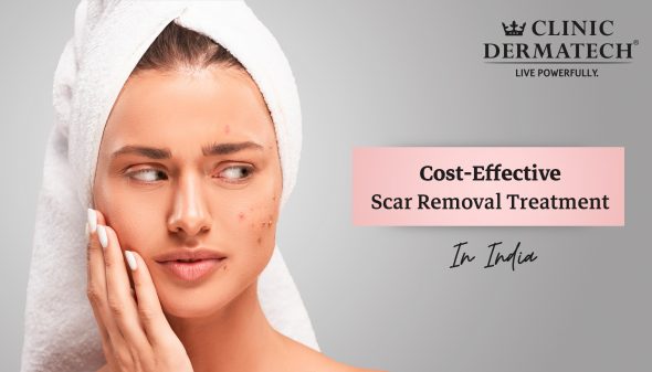 Cost-Effective Scar Removal Treatment In India