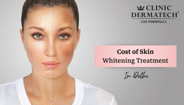Cost of Skin Whitening Treatment in Delhi