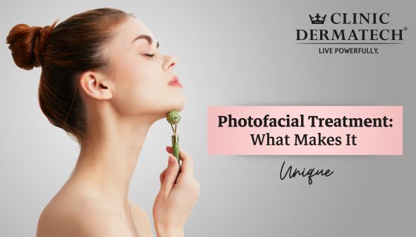 Photofacial Treatment: What Makes It Unique