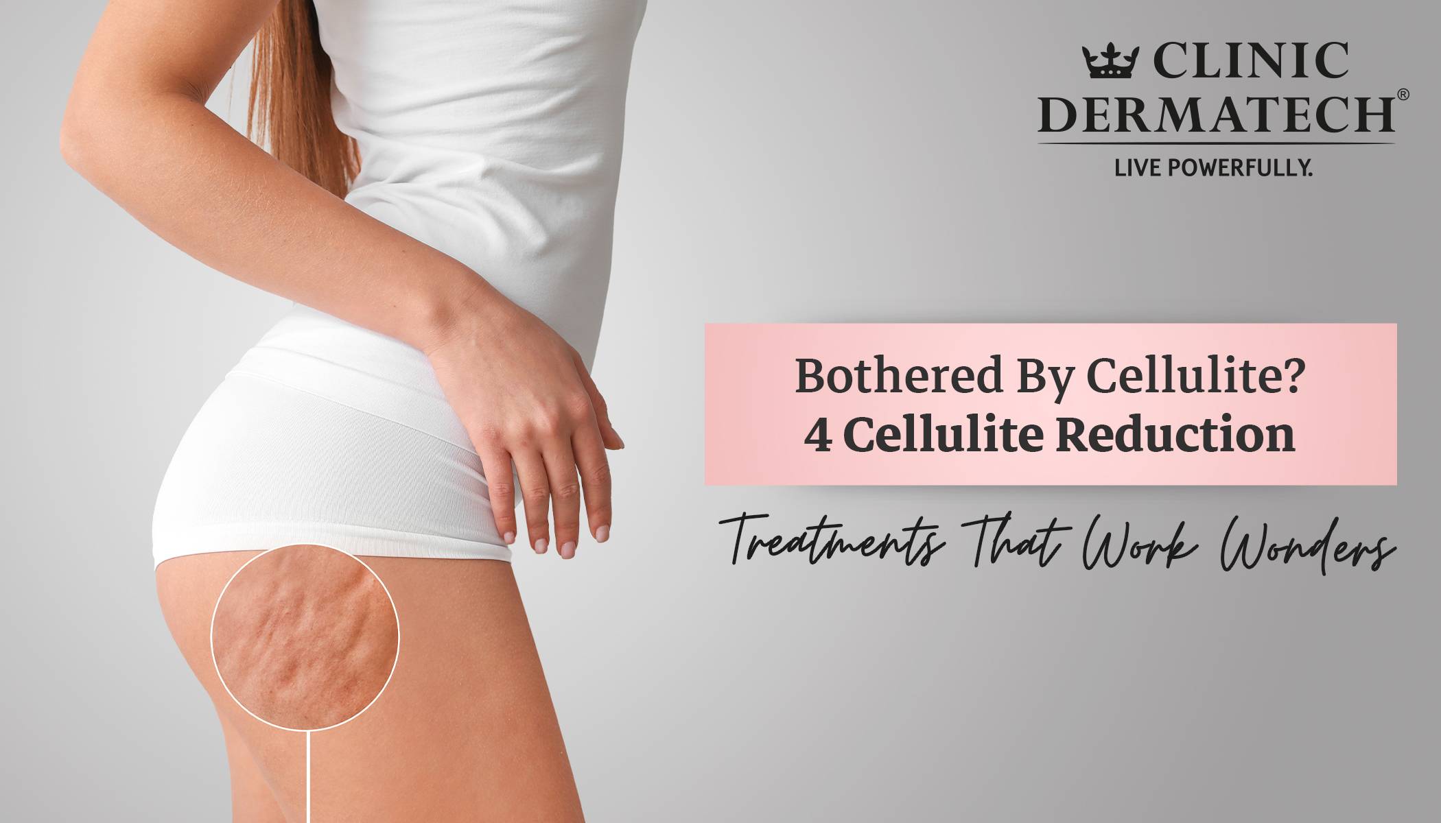 Cellulite reduction treatments that work