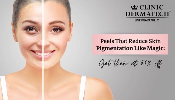 Peels That Reduce Skin Pigmentation Like Magic: Get Them At 51% Off