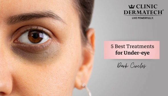 5 Best Treatments for Under-Eye Dark Circles