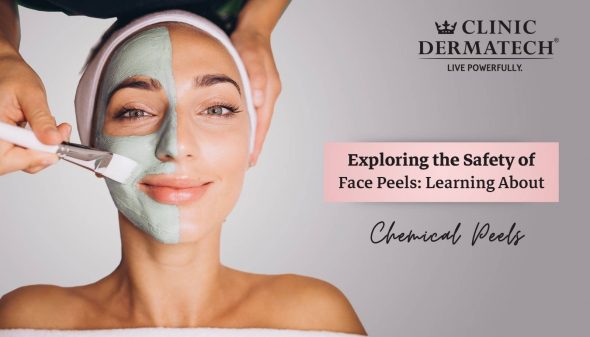 Exploring the Safety of Face Peels: Learning About Chemical Peels