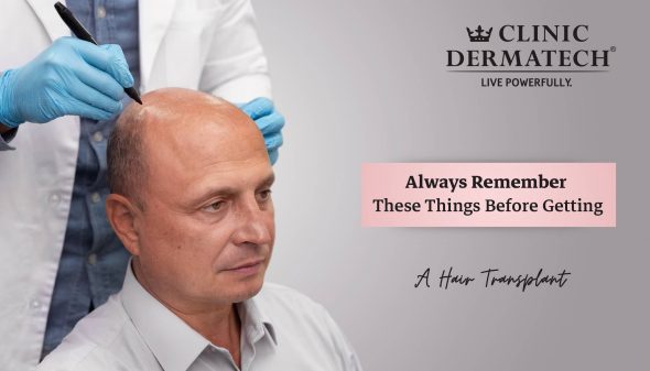 Always Remember These Things Before Getting A Hair Transplant