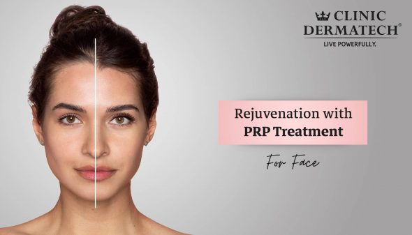 Rejuvenation with PRP Treatment for Face