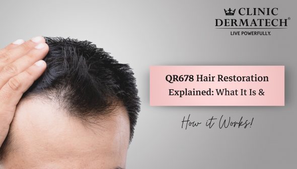 QR678 Hair Restoration Explained: What It Is & How It Works.