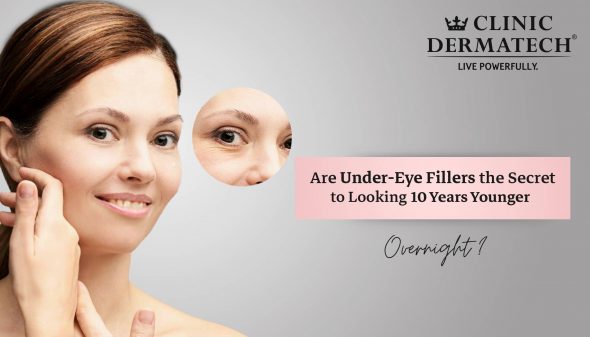Are Under-Eye Fillers the Secret to Looking 10 Years Younger Overnight?