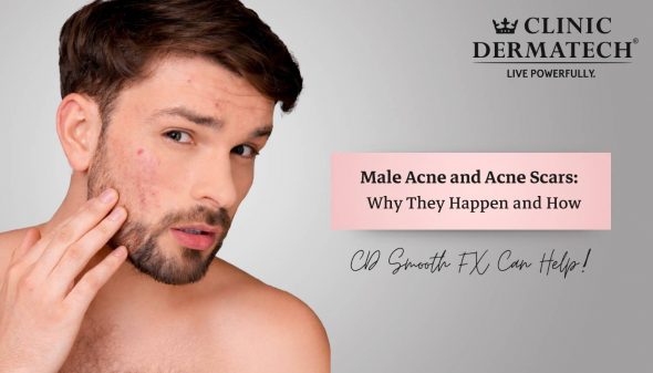 Male Acne and Acne Scars: Why They Happen and How CD Smooth FX Can Help