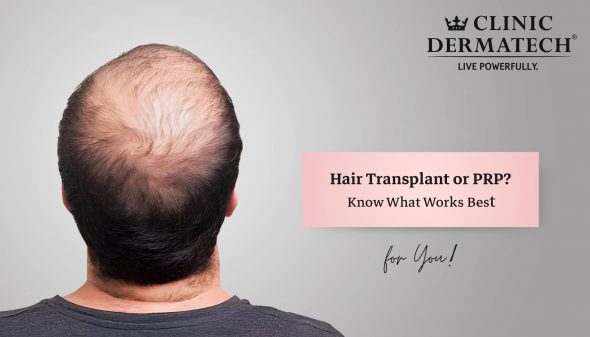 Hair Transplant or PRP? Know What Works Best for You!